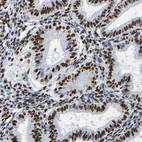 Immunohistochemical staining of human endometrium shows strong nuclear positivity in glandular cells.