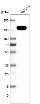 Western blot analysis in human cell line MOLT-4.