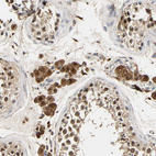 Immunohistochemical staining of human testis shows strong cytoplasmic positivity in Leydig cells.