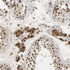 Immunohistochemical staining of human testis shows strong cytoplasmic positivity in Leydig cells.