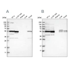 Western blot analysis using Anti-SMU1 antibody HPA019708 (A) shows similar pattern to independent antibody HPA019228 (B).
