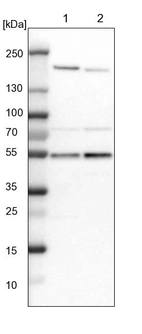 Lane 1: NIH-3T3 cell lysate (Mouse embryonic fibroblast cells)_br/_Lane 2: NBT-II cell lysate (Rat Wistar bladder tumour cells)