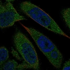 Immunofluorescent staining of human cell line PC-3 shows localization to cytosol.