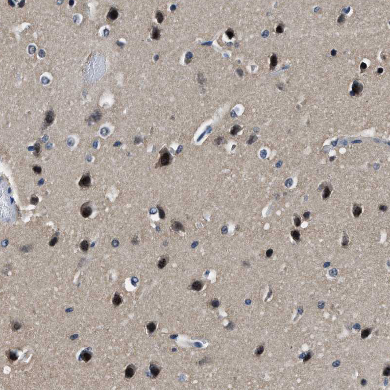 Anti-LANCL2 Antibody