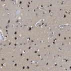 Anti-LANCL2 Antibody