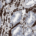 Immunohistochemical staining of human prostate shows strong cytoplasmic positivity in smooth muscle cells.