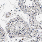 Immunohistochemical staining of human testis shows moderate nuclear positivity in a subset of cells in seminiferous ducts.
