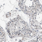 Immunohistochemical staining of human testis shows moderate nuclear positivity in a subset of cells in seminiferous ducts.