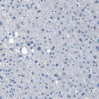 Immunohistochemical staining of human liver shows no positivity in hepatocytes as expected.
