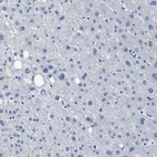 Immunohistochemical staining of human liver shows no positivity in hepatocytes as expected.