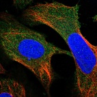 Immunofluorescent staining of human cell line U-2 OS shows localization to cytosol.
