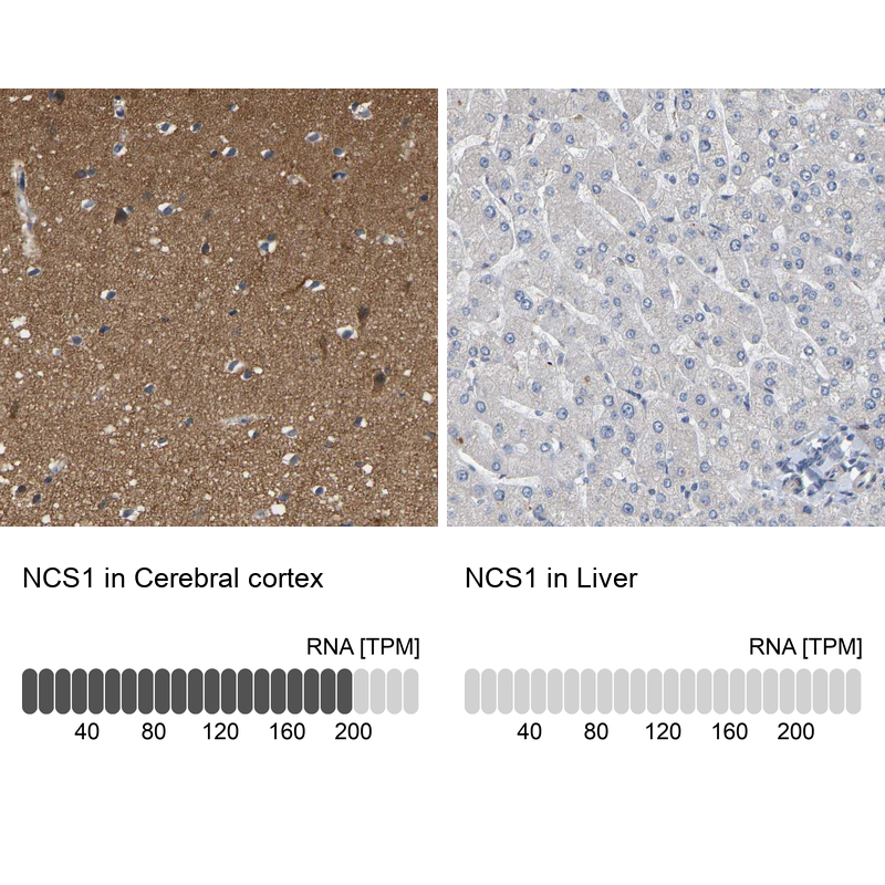 Anti-NCS1 Antibody