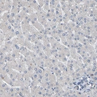 Immunohistochemical staining of human liver shows low expression as expected.