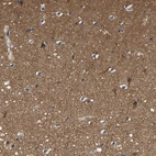 Immunohistochemical staining of human cerebral cortex shows high expression.