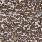 Immunohistochemical staining of human liver shows strong positivity in cytoplasm granular in hepatocytes.