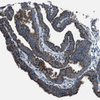 Immunohistochemical staining of human fallopian tube shows strong positivity in cytoplasm granular in cells in tubules.