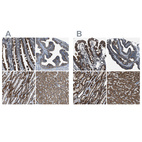 Anti-MDH2 Antibody