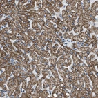 Immunohistochemical staining of human liver shows strong positivity in cytoplasm granular in hepatocytes.