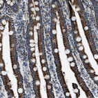 Immunohistochemical staining of human duodenum shows strong positivity in cytoplasm granular in glandular cells.