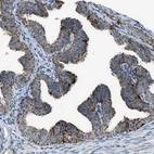 Immunohistochemical staining of human fallopian tube shows strong positivity in cytoplasm granular in glandular cells.