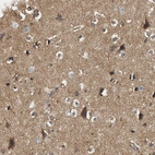 Anti-RAB31 Antibody