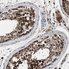Immunohistochemical staining of human testis shows high expression.