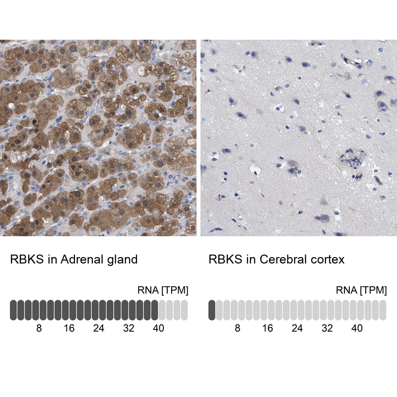 Anti-RBKS Antibody