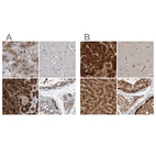 Immunohistochemical staining of human adrenal gland, cerebral cortex, liver and testis using Anti-RBKS antibody HPA019725 (A) shows similar protein distribution across tissues to independent antibody HPA028285 (B).