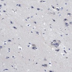 Immunohistochemical staining of human cerebral cortex shows low expression as expected.