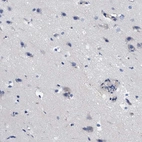 Immunohistochemical staining of human cerebral cortex shows low expression as expected.