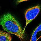 Immunofluorescent staining of human cell line U-2 OS shows localization to cytosol.