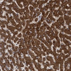 Immunohistochemical staining of human liver shows strong cytoplasmic granular positivity in hepatocytes.