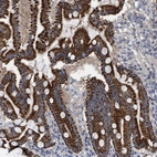 Immunohistochemical staining of human duodenum shows strong cytoplasmic positivity in glandular cells.