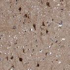 Immunohistochemical staining of human cerebral cortex shows strong cytoplasmic positivity in neuronal cells.