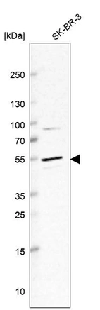 Western blot analysis in human cell line SK-BR-3.