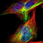 Immunofluorescent staining of human cell line U-251 MG shows localization to intermediate filaments & aggresome.