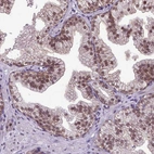 Immunohistochemical staining of human prostate shows moderate nuclear positivity in glandular cells.
