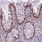 Immunohistochemical staining of human rectum shows moderate nuclear positivity in glandular cells.