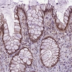 Immunohistochemical staining of human rectum shows moderate nuclear positivity in glandular cells.