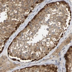 Immunohistochemical staining of human testis shows moderate to strong cytoplasmic positivity in cells in seminiferous ducts.