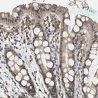 Immunohistochemical staining of human rectum shows moderate cytoplasmic positivity in glandular cells.