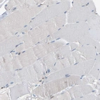 Immunohistochemical staining of human skeletal muscle shows no positivity in myocytes as expected.