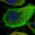 Immunofluorescent staining of human cell line A-431 shows localization to plasma membrane & cytosol.