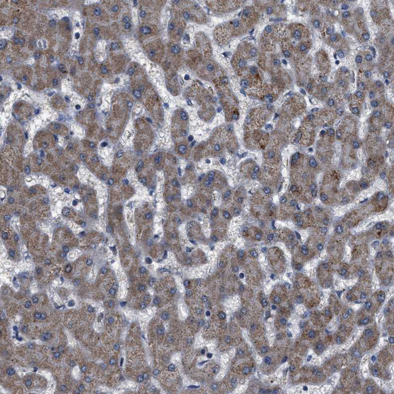 Anti-DDX56 Antibody