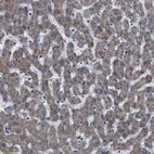 Anti-DDX56 Antibody