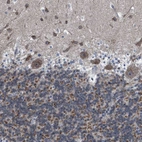 Immunohistochemical staining of human cerebellum shows moderate cytoplasmic positivity in Purkinje cells.