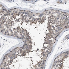 Immunohistochemical staining of human testis shows moderate cytoplasmic positivity in cells in seminiferous ducts.