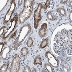 Immunohistochemical staining of human kidney shows moderate to strong cytoplasmic positivity in cells in tubules.