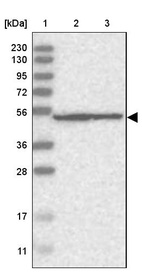 Lane 1: Marker [kDa] 230, 130, 95, 72, 56, 36, 28, 17, 11_br/_Lane 2: Human cell line RT-4_br/_Lane 3: Human cell line U-251MG sp