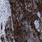 Anti-CEACAM5 Antibody